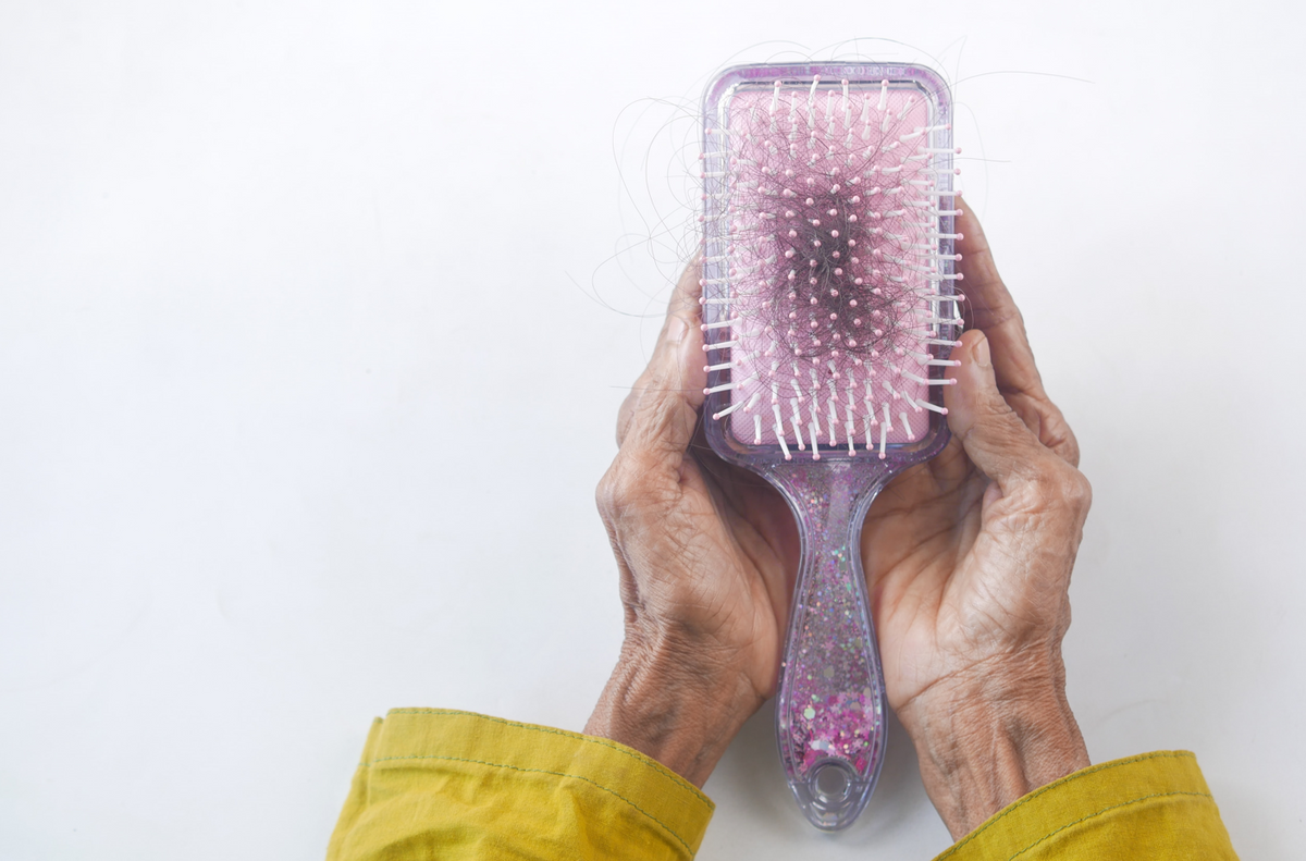 alopecia areata cause e rimedi